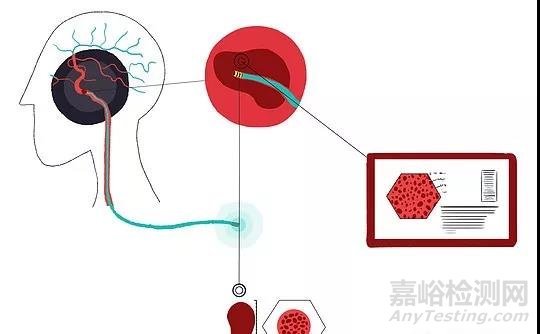 2018全球十大最具黑科技的医械产品