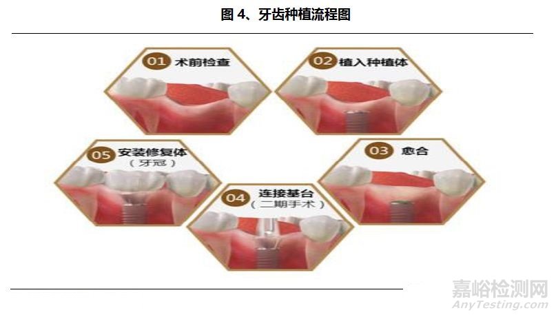 口腔医疗行业研究报告——器械篇