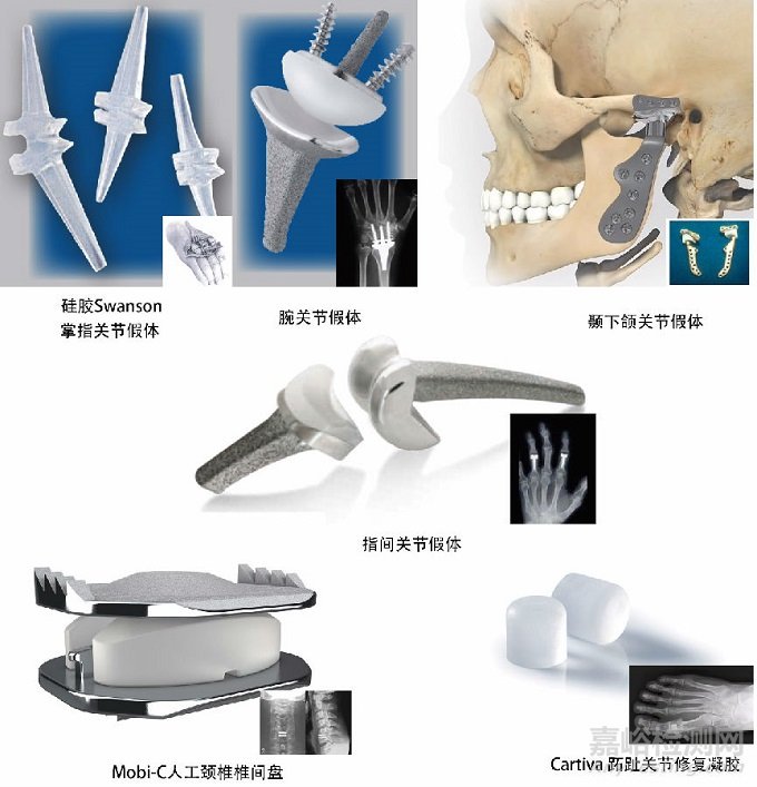 【医疗器械】人工踝关节假体设计