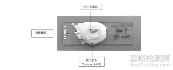 硬组织切磨技术及操作要点