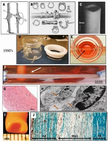 Science综述：人造血管