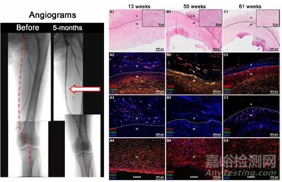 Science综述：人造血管