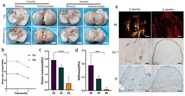 3D生物打印仿生半月板支架应用于组织工程领域