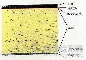 国产人工角膜6月用于临床，超全的人工角膜研发科普贴