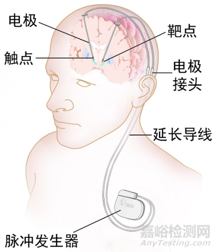 基于MSP430的可充电脑起搏器的设计方案