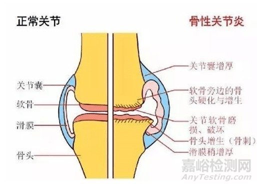 FDA批准指导膝关节置换术的智能眼镜