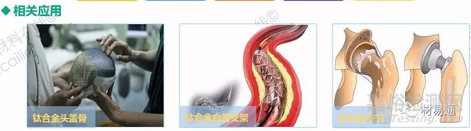 生物医用金属材料现状与进展