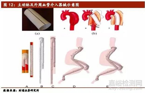 医疗介入器械行业深度报告