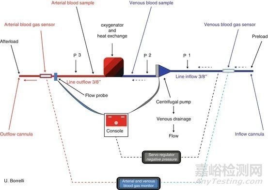 ECMO