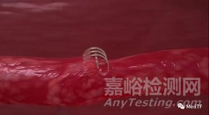 Venock vascular closure：完全可吸收的大口径静脉血管闭合器