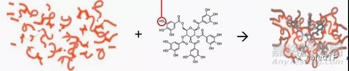 Nectero EAST：胶水修复腹主动脉瘤