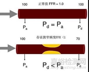 机器学习在心血管影像诊断上的应用