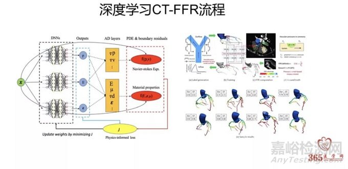 机器学习在心血管影像诊断上的应用