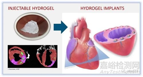 TCMR：心肌注入水凝胶治疗心衰