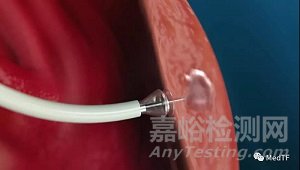 TCMR：心肌注入水凝胶治疗心衰