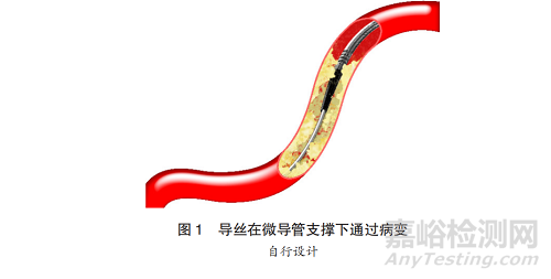 微导管的结构与技术发展