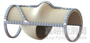 生物静脉瓣VenoValve：公布FIM长期临床结果 30月反流平均改善为 55%