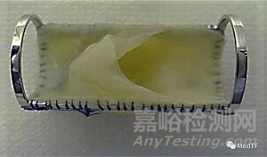 生物静脉瓣VenoValve：公布FIM长期临床结果 30月反流平均改善为 55%