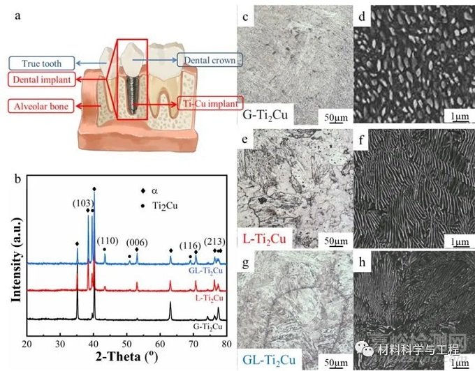 《Mater Des》：牙科用Ti-Cu合金的生物腐蚀行为和抗菌性能！