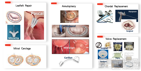 中国心脏瓣膜行业回顾、对比和展望