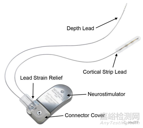 RNS System：FDA唯一批准的闭环脑反应神经刺激系统预防癫痫发作