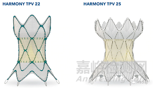 Harmony全球首款自膨胀肺动脉瓣，临床证实其中长期安全性和有效性