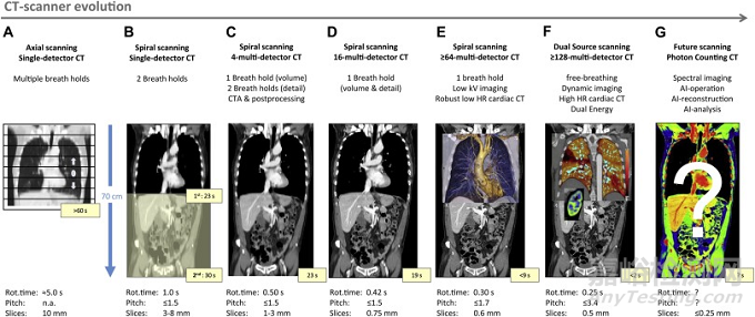 全球CT技术发展过程与趋势