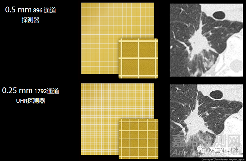 全球CT技术发展过程与趋势