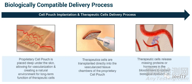 Cell Pouch：潜在糖尿病治愈技术 无需注射胰岛素