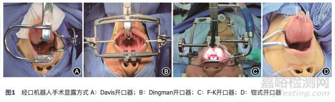 达芬奇Xi手术机器人在经口咽喉肿瘤手术中的可行性及围手术期安全性探讨