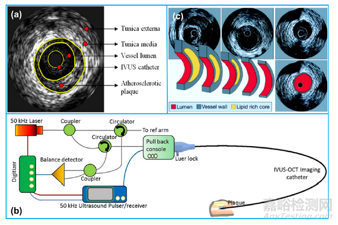 血管内超声（IVUS）的器械构成及技术趋势