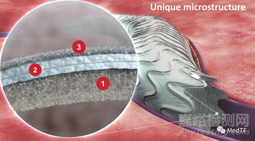 Wrapsody：不透细胞的覆膜支架 避免/减少再狭窄