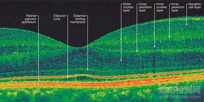 冠脉血管疾病的三大评估器械：IVUS、OCT、FFR