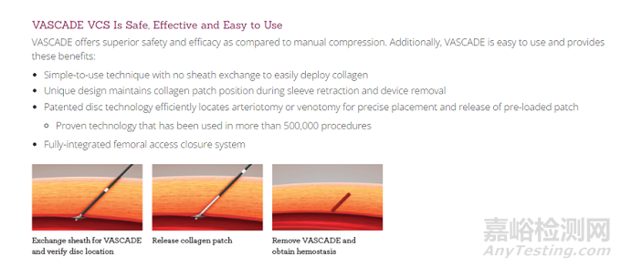 唯一一款FDA获批的血管和静脉闭合装置Vascade MVP再获CE批准