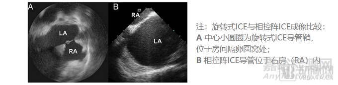 心腔内超声（ICE）行业研究