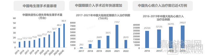 心腔内超声（ICE）行业研究