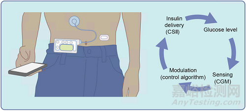 新的植入式装置设计或将推动人工胰腺发展