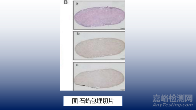 用于输尿管再生的3D打印活细胞结构