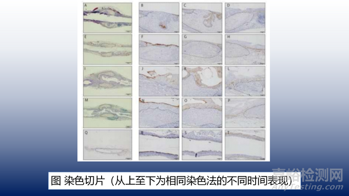 用于输尿管再生的3D打印活细胞结构