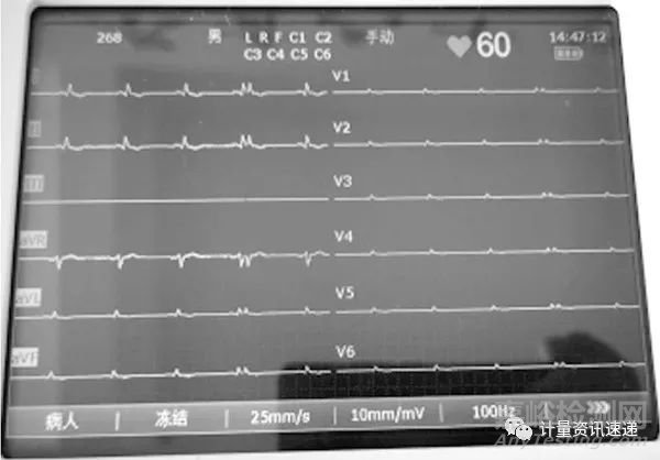 光电数字心电图机计量检定心率不显示问题的探讨
