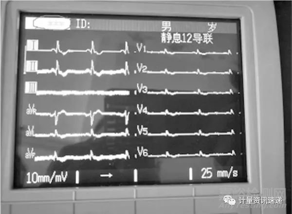 光电数字心电图机计量检定心率不显示问题的探讨
