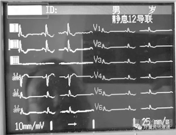 光电数字心电图机计量检定心率不显示问题的探讨