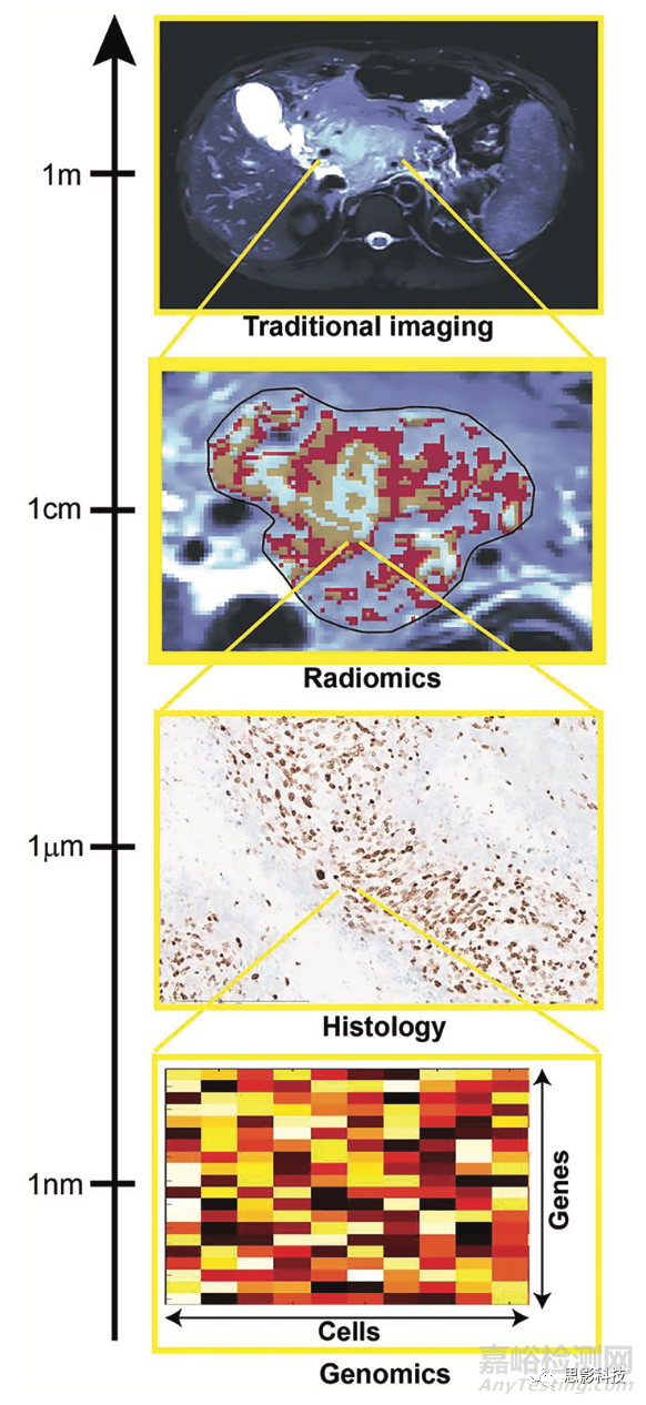 Radiology：影像组学特征的生物学意义