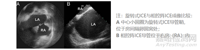 心腔内超声（ICE）行业市场分析