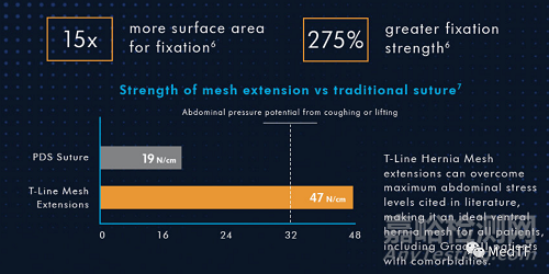 T-Line Hernia Mesh：具有缝合功能的疝气补片