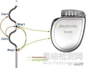 美敦力血管外植入式心律转复除颤器获CE批准上市