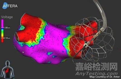 Affera：美敦力首款三维标测和消融系统获CE批准