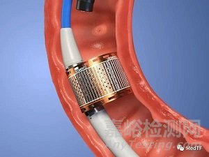 ReCET：电脉冲消融治疗糖尿病